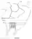 Fig. 05 - ADJUSTABLE WRENCH HAVING NUT-GRIPPING JAWS