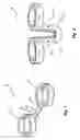 Fig. 02 - Clip-in nostril expander