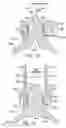 Fig. 09 - Forehead pad for respiratory mask