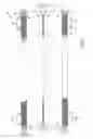 Fig. 02 - Plug bypass valves and heat exchangers