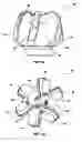 Fig. 02 - Fixed cutter rotary drill bit including support elements affixed to the bit body at least partially defining cutter pocket recesses