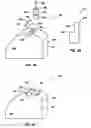 Fig. 07 - Fixed cutter rotary drill bit including support elements affixed to the bit body at least partially defining cutter pocket recesses