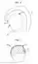Fig. 02 - Method for fabricating a medical implant component and such component