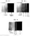 Fig. 05 - Method for fabricating a medical implant component and such component