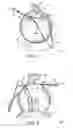 Fig. 02 - METHODS FOR REMOVING SAND OR DEBRIS FROM A PERSON USING A SPRAYER
