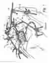 Fig. 02 - Surgical clamp and tool support system