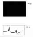 Fig. 57 - Ion sources, systems and methods