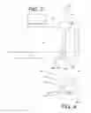 Fig. 03 - Thermally balanced via