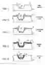Fig. 02 - Method to improve time dependent dielectric breakdown