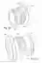 Fig. 12 - Hydraulically damped mounting device