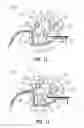 Fig. 10 - Sheet-feeding apparatus with a paper stopper