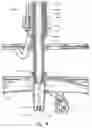 Fig. 11 - Chair with adjustable foot support