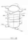 Fig. 04 - Stator structure