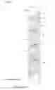Fig. 04 - Ink-jet head
