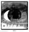 Fig. 02 - Transcleral opthalmic illumination method and system