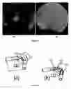 Fig. 07 - Transcleral opthalmic illumination method and system