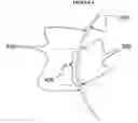 Fig. 04 - Method and apparatus for controlling peripheral image position for reducing progression of myopia