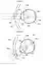 Fig. 07 - Method and apparatus for controlling peripheral image position for reducing progression of myopia