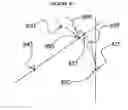 Fig. 08 - Method and apparatus for controlling peripheral image position for reducing progression of myopia