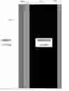 Fig. 01 - Surveillance window