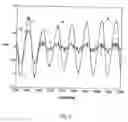 Fig. 09 - Method for operating a wind turbine during a disturbance in the grid