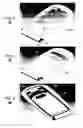 Fig. 03 - Insert molded flexible circuit with stiffener and flip housing assembly and method of manufacture