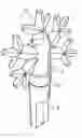 Fig. 01 - Bulb assembly with a decorative cover