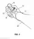 Fig. 03 - Thumb anchored watch for runners