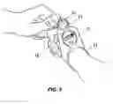 Fig. 04 - Thumb anchored watch for runners
