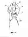 Fig. 05 - Thumb anchored watch for runners