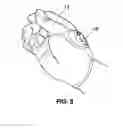 Fig. 06 - Thumb anchored watch for runners