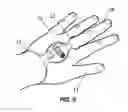 Fig. 07 - Thumb anchored watch for runners