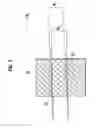 Fig. 04 - Electromagnetic wave generating device