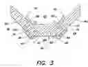Fig. 04 - Molded binder