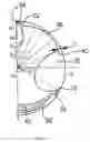 Fig. 06 - End mill and a method of operating an end mill