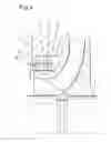 Fig. 04 - Flow machine for a fluid with a radial sealing gap