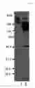 Fig. 09 - Remedy for prion disease and method of producing the same