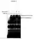 Fig. 06 - Interleukin-22 polypeptides, nucleic acids encoding the same and methods for the treatment of pancreatic disorders