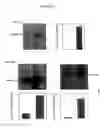 Fig. 07 - Interleukin-22 polypeptides, nucleic acids encoding the same and methods for the treatment of pancreatic disorders