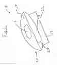 Fig. 02 - Hemostatic agent delivery system