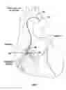 Fig. 08 - PostConditioning System And Method For The Reduction Of Ischemic-Reperfusion Injury In The Heart And Other Organs