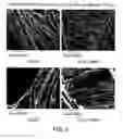 Fig. 04 - Hemostatic textile