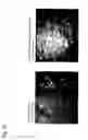 Fig. 48 - Targeting and intestinal-absorption controlled liposome having sugar chain and therapeutic drug for cancer and diagnostic drug containing the liposome