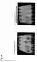 Fig. 50 - Targeting and intestinal-absorption controlled liposome having sugar chain and therapeutic drug for cancer and diagnostic drug containing the liposome