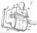 Fig. 01 - Orthodontic bracket