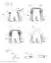 Fig. 03 - Process for the retraction of sulcus
