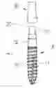 Fig. 05 - Temporary Implant Connection Structure