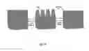 Fig. 14 - Method and apparatus for tooth rejuvenation and hard tissue modification