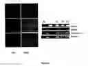 Fig. 03 - Human embryonic stem cell clones