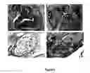 Fig. 07 - Human embryonic stem cell clones